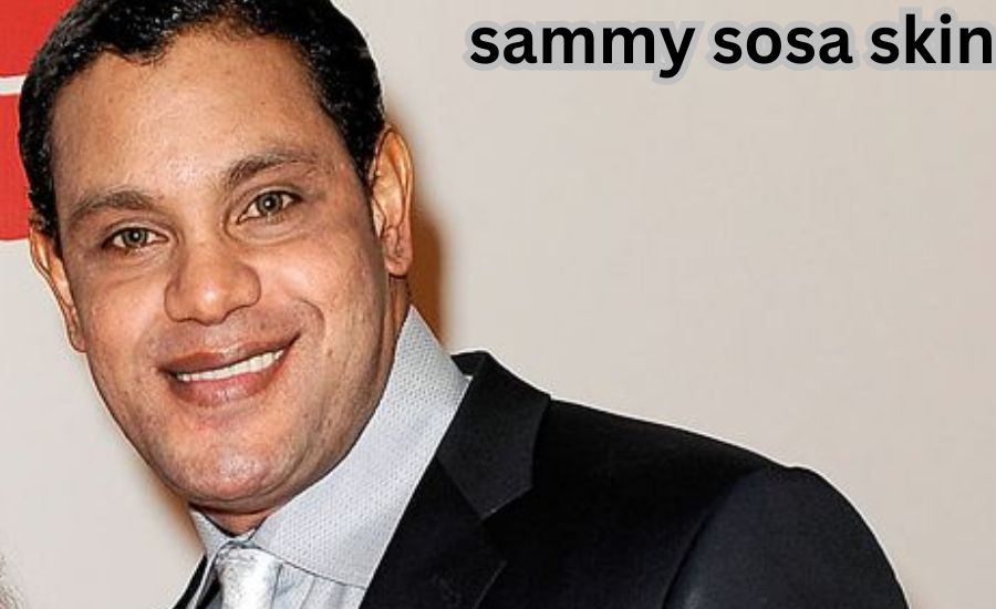 sammy sosa skin